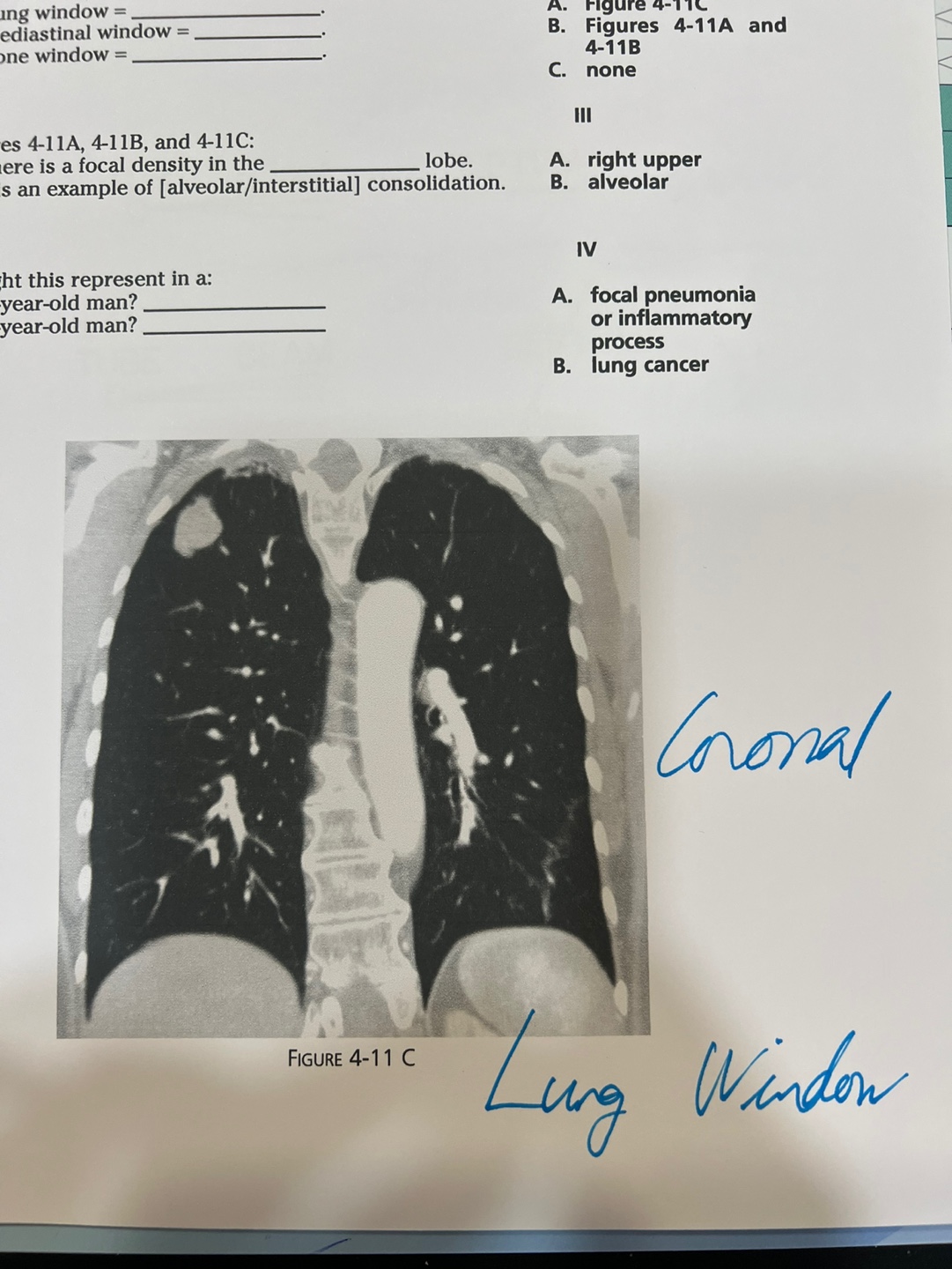 CT Image 11B