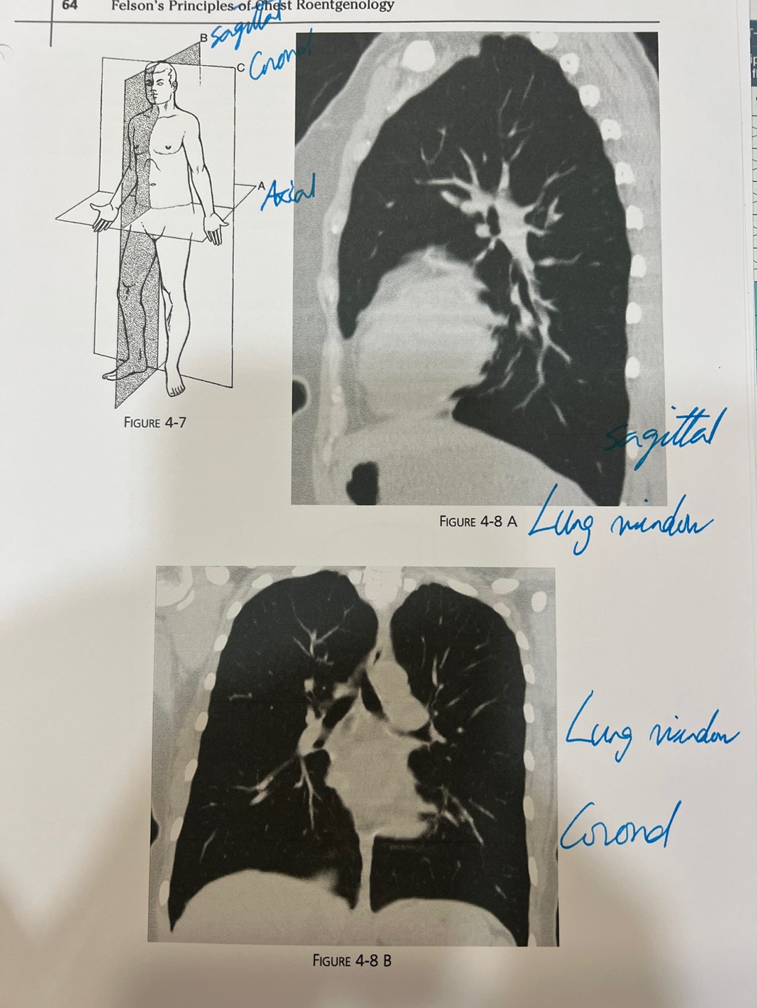 CT Image 8A