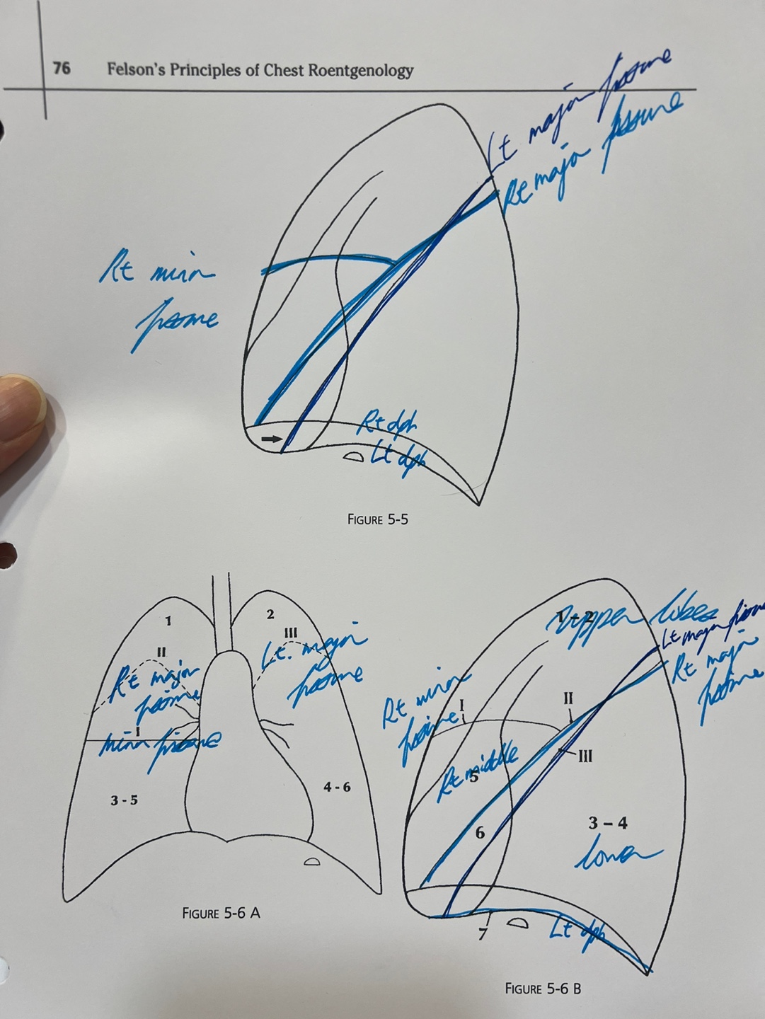 Main diagram image